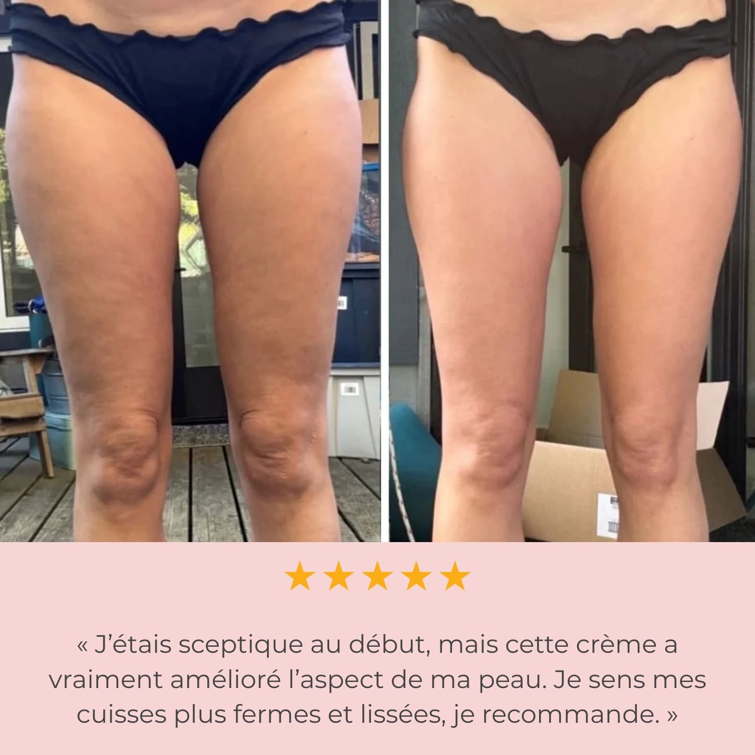 Creme Anti-Cellulite & raffermissante B-Smooth