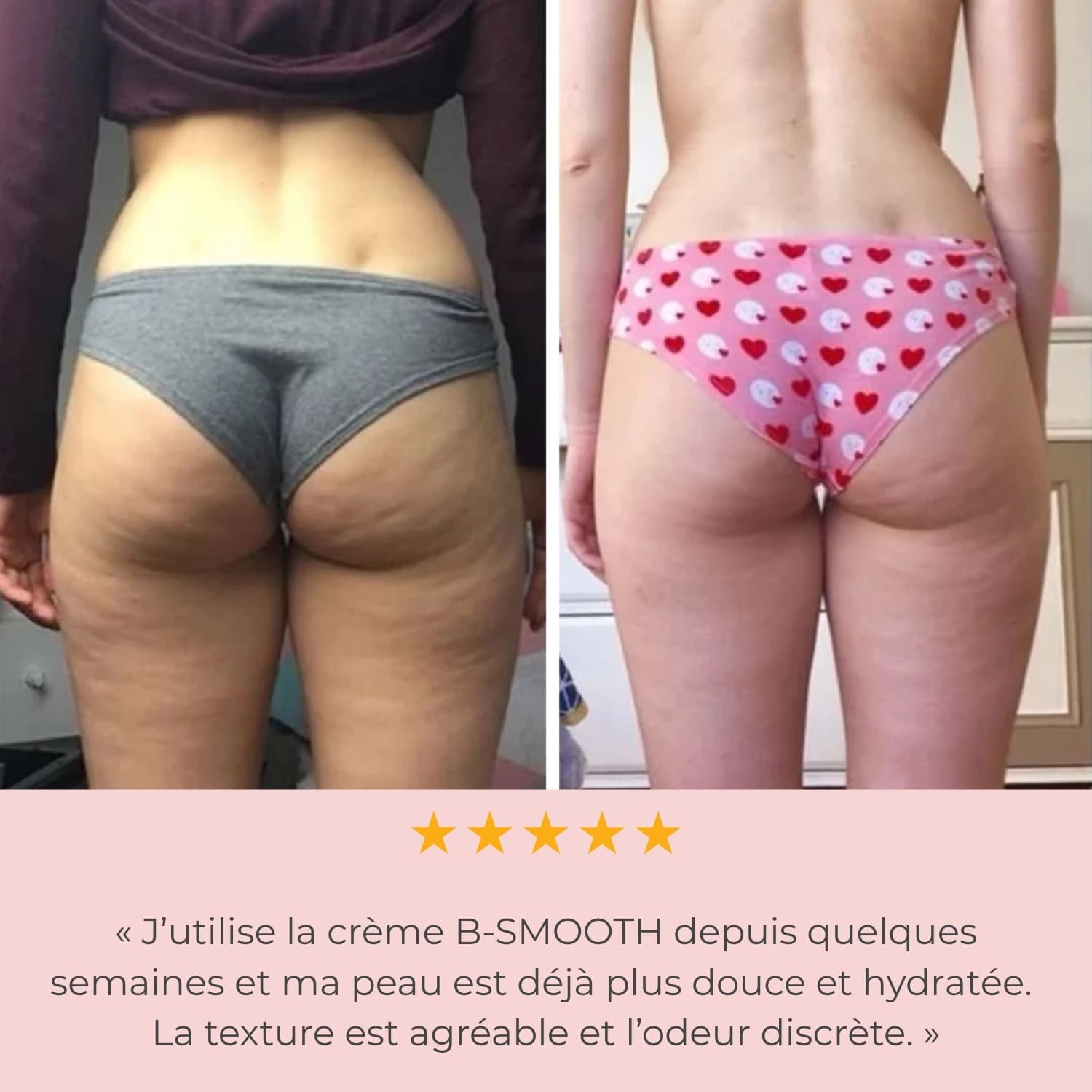 Creme Anti-Cellulite & raffermissante B-Smooth