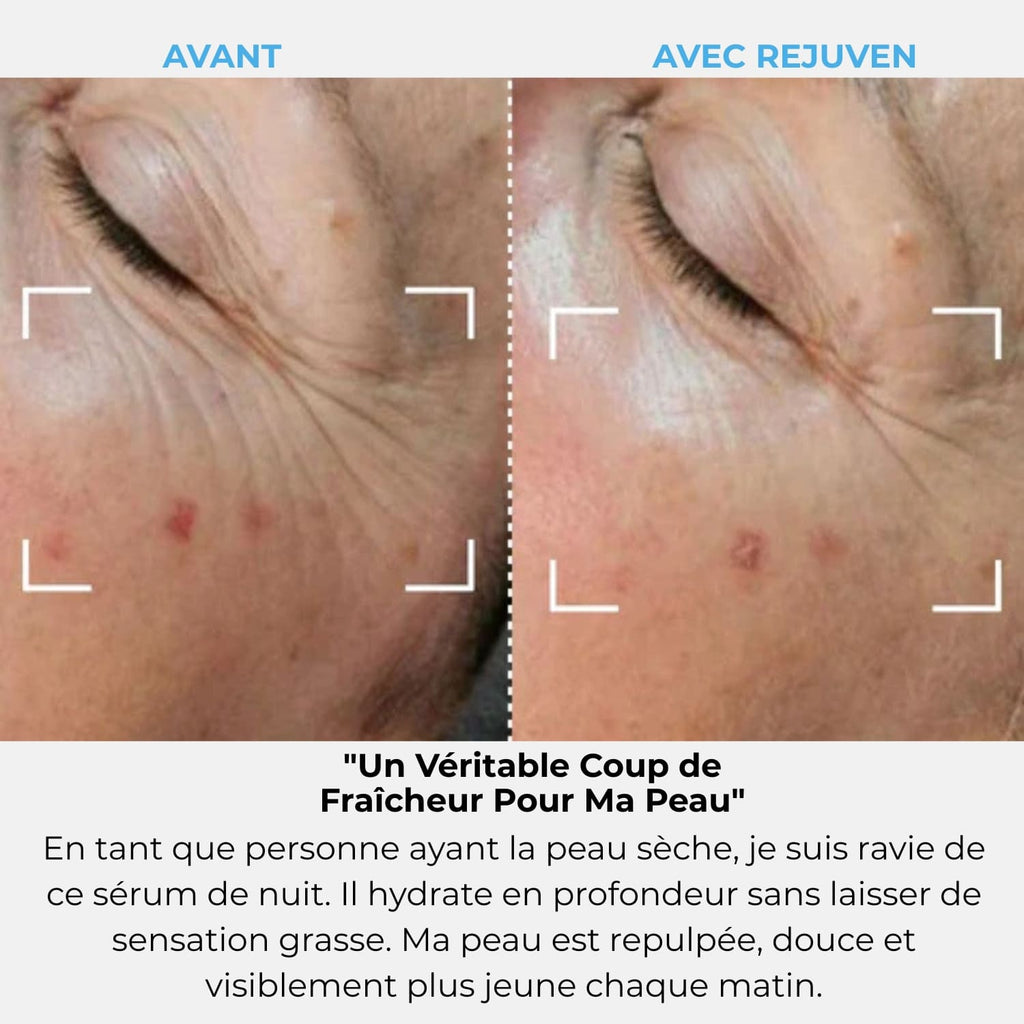 Abonnement Rejuven